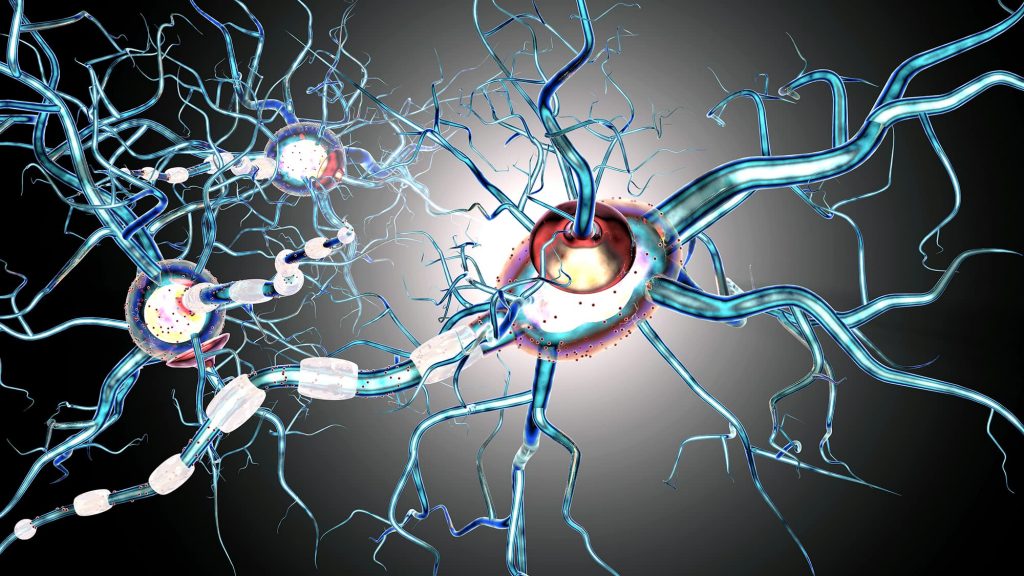 Multiple sclerosis.