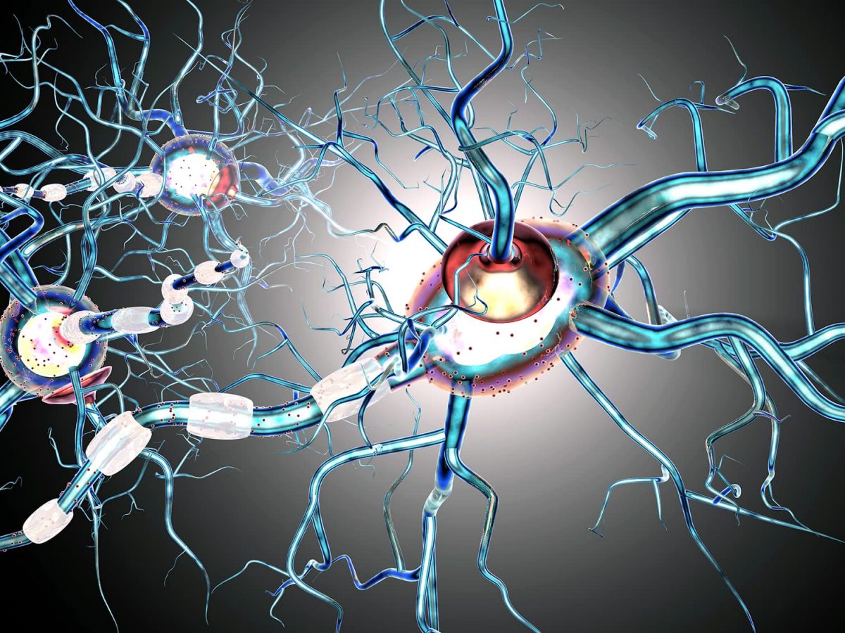 Multiple sclerosis.