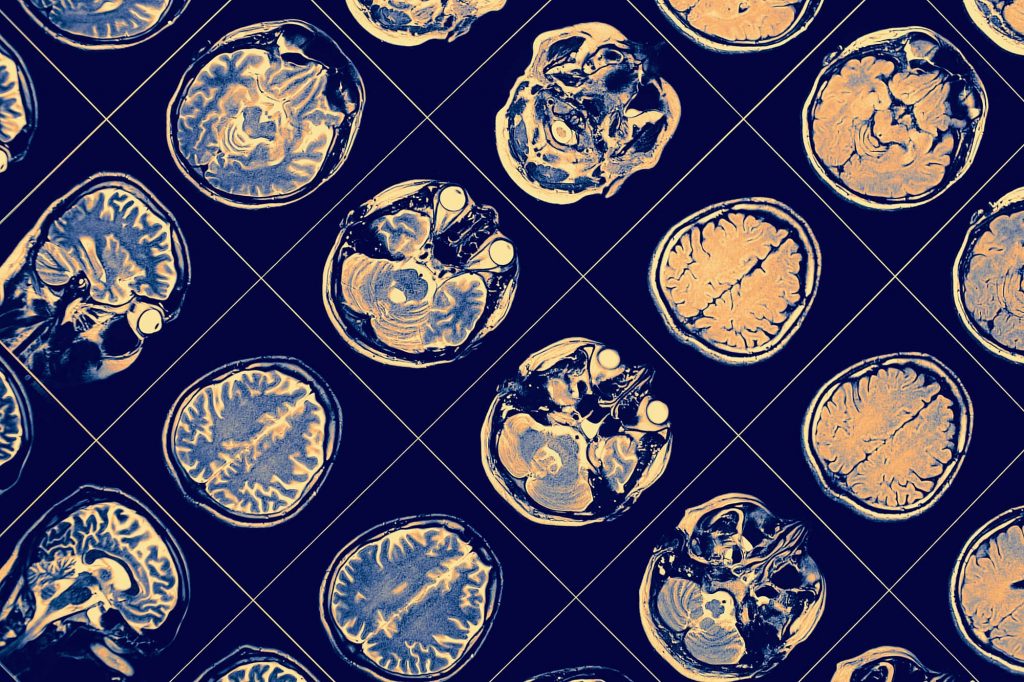 brain