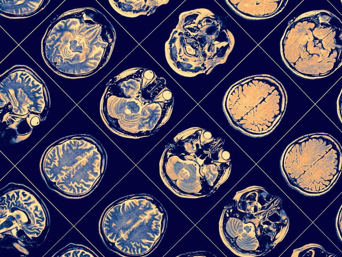 brain