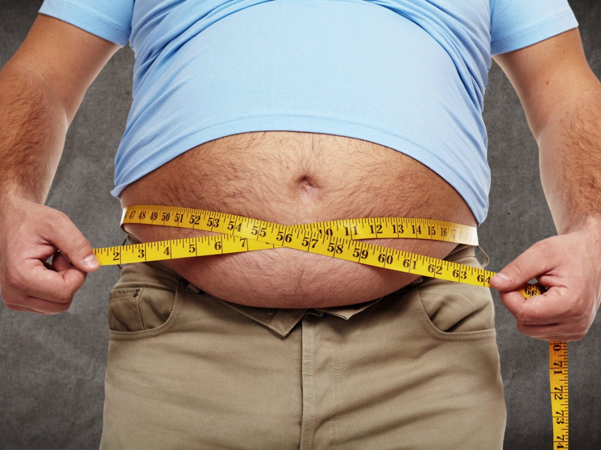 obesity