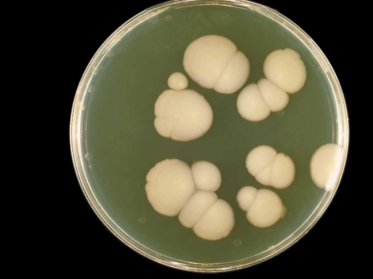candida-albicans