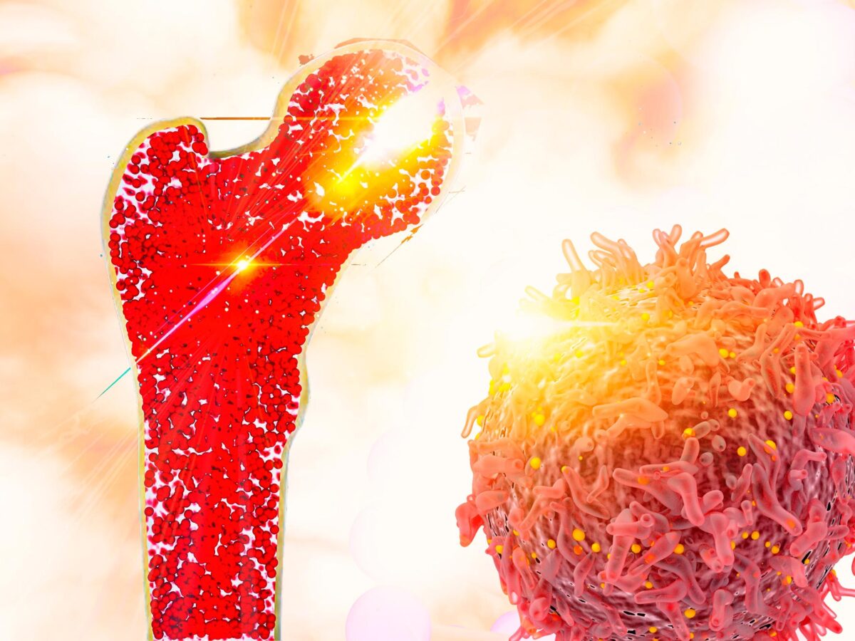 Tecvayli: New Drug for Multiple Myeloma